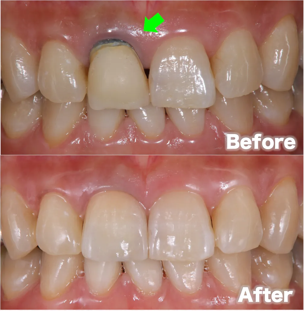 ①根が黒いbefore after