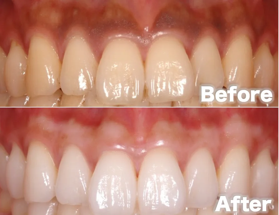 YASU DENTAL CLINICでは無料カウンセリングを行っております。