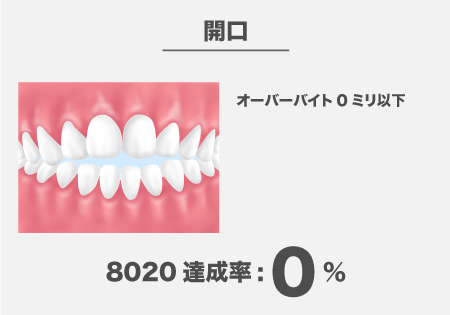 噛み合わせの重要性