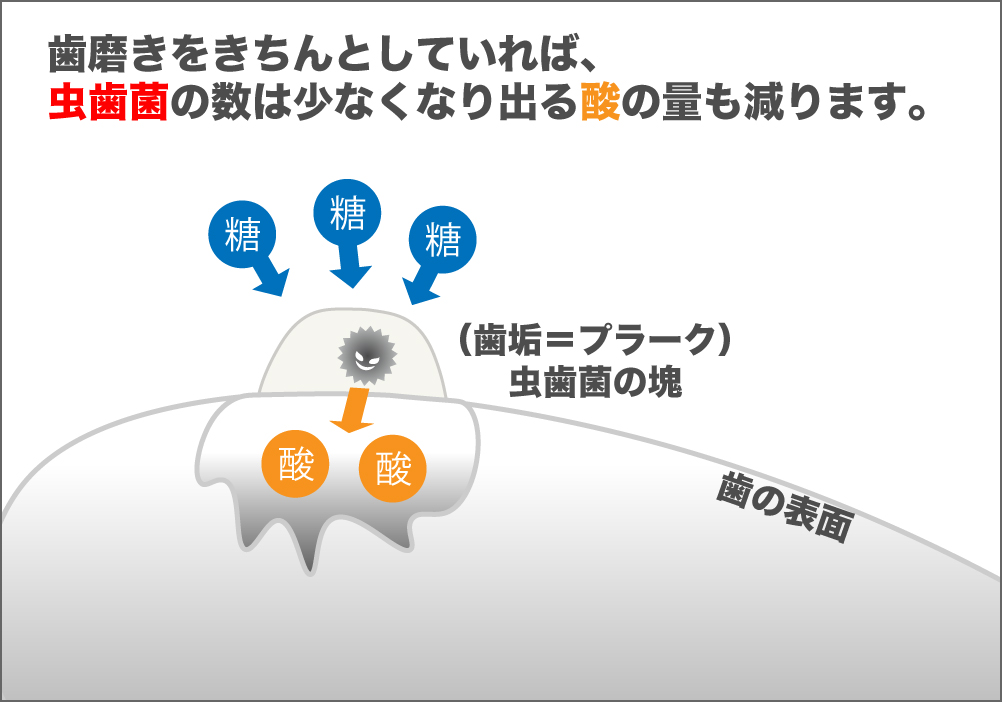 虫歯にならないためには