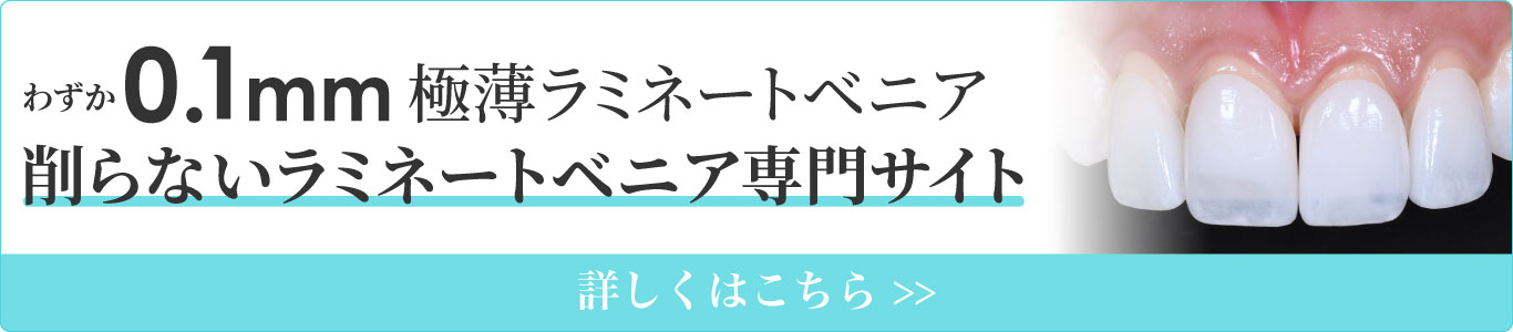 削らないラミネートべニア専門サイト