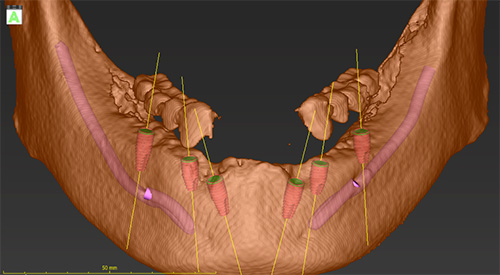 シミュレーション画像