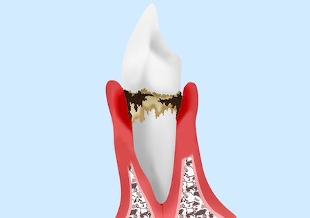 見せかけだけの綺麗な状態