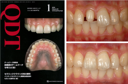 Quintessence of Dental Technology 2018年1月号