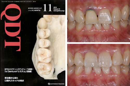 Quintessence of Dental Technology 2018年11月号